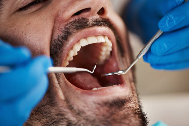Best Broken or Cracked Tooth Emergency Dentist in Fresno, CA
