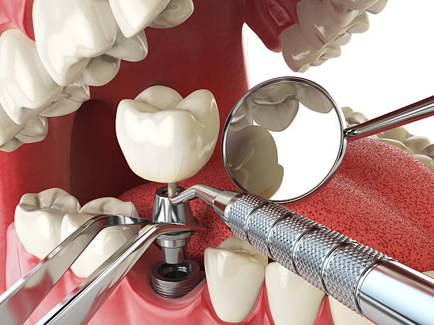 Best Mobile Emergency Dentist in Fresno, CA