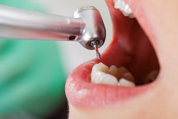 Best Emergency Cosmetic Dentistry in Fresno, CA